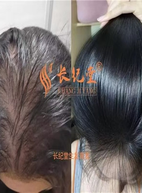 发仕源人参植萃养发液粗壮浓密