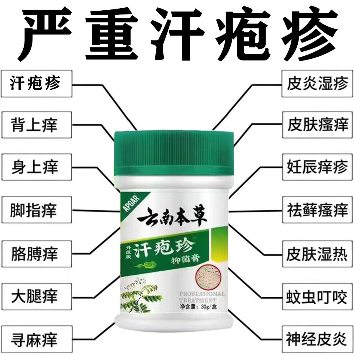 云南本草汗泡珍汗泡疱疹药膏汉汗状手上小水泡克星专用软膏汗孢疹 - 图0