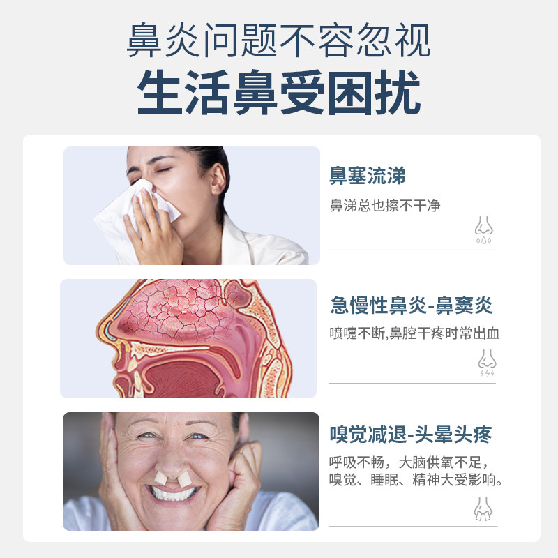 健尔马鼻炎治疗仪器过敏性鼻炎仪 健尔马理疗仪（器械）