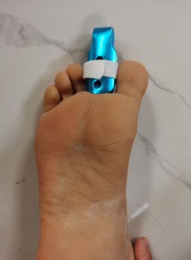 脚趾固定器大小脚指固定护具
