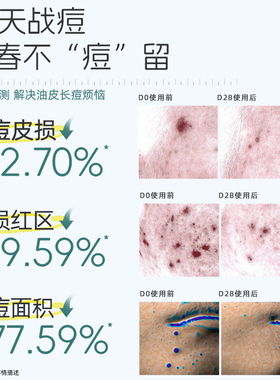 善草纪青春版茶树控油祛痘水乳套装补水保湿淡化痘印学生护肤品