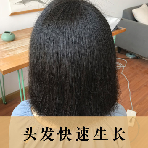内调+外养 更健康 更蓬松 掉得更少 让该长的 还能长的 长起来 - 图1