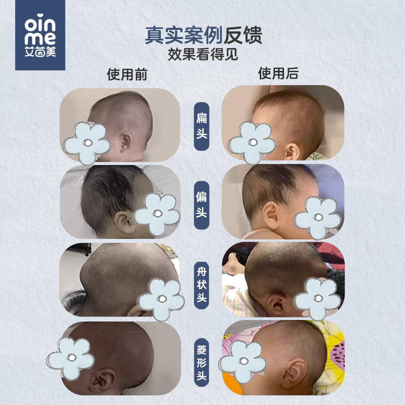 艾茵美婴儿定型枕头0到6个月以上睡圆头矫正头型防偏头儿童宝宝枕
