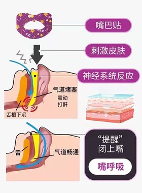腺样体肥大面容矫正器闭嘴呼吸贴