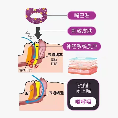 Образец образец железы гипертрофический корректор лица Детский анти -майт -дыхание и спящий коррек