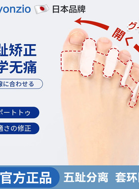 日本脚指头分离矫正拇指外翻分趾