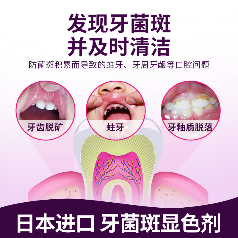 日本丹平牙菌斑显示剂儿童口腔祛除牙垢神器显色可视指示剂染色液