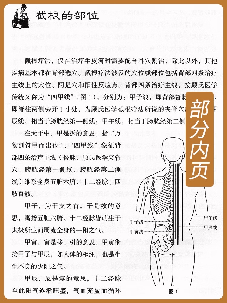 当当网截根疗法濒临失传的中医绝技治疗癌症恶性肿瘤肝胆病银屑病不孕症治疗精神障碍疾病治疗中医疗法中医调理肿瘤特色方药-图2