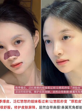 童颜纪厚脸皮修护屏障舒缓面膜