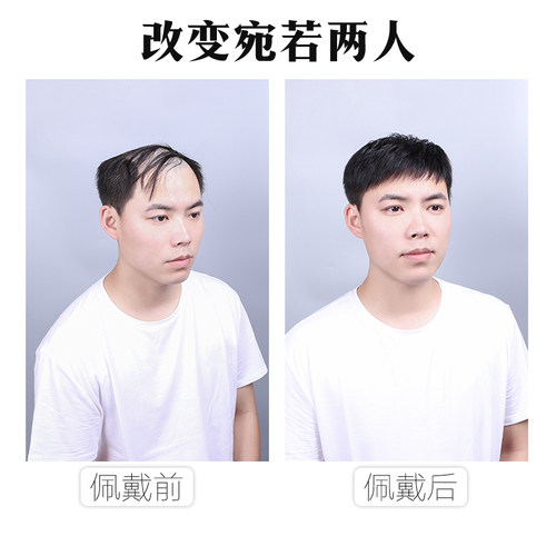男士补发片假发套头顶补发前额秃顶补发垫接发翻盖假发真发男发块 - 图0