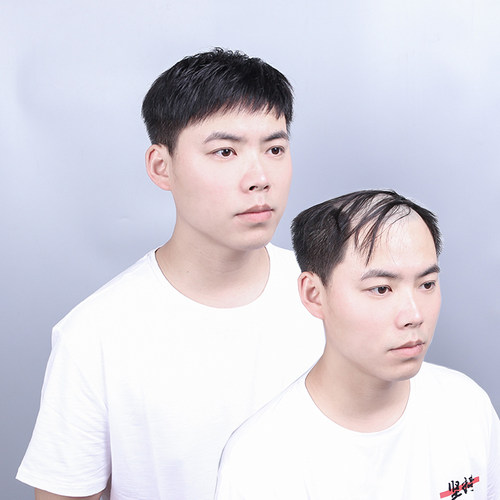 男士补发片假发套头顶补发前额秃顶补发垫接发翻盖假发真发男发块 - 图2