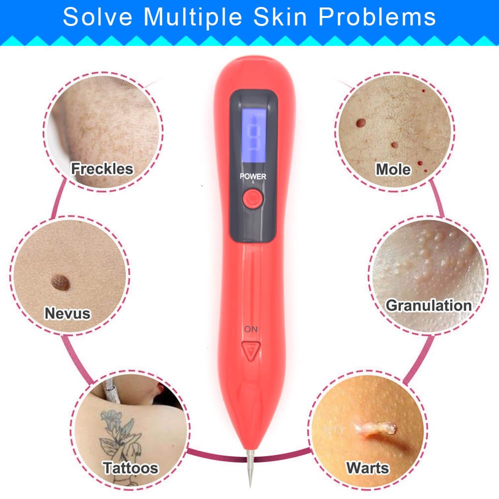 Mole Nevus Removal Laser Pen Wart Plasma Remover Skin Tattoo-图0