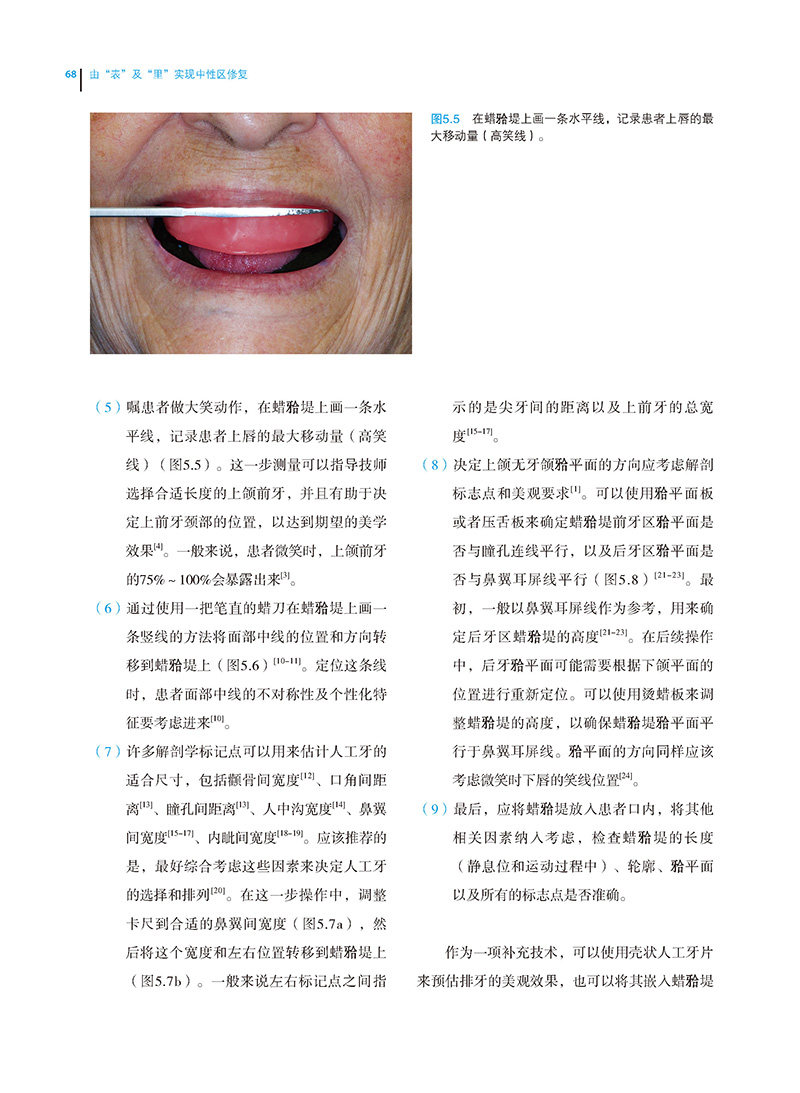 由表里实现中性区修复约瑟夫义齿 世纪在线图书口腔科学