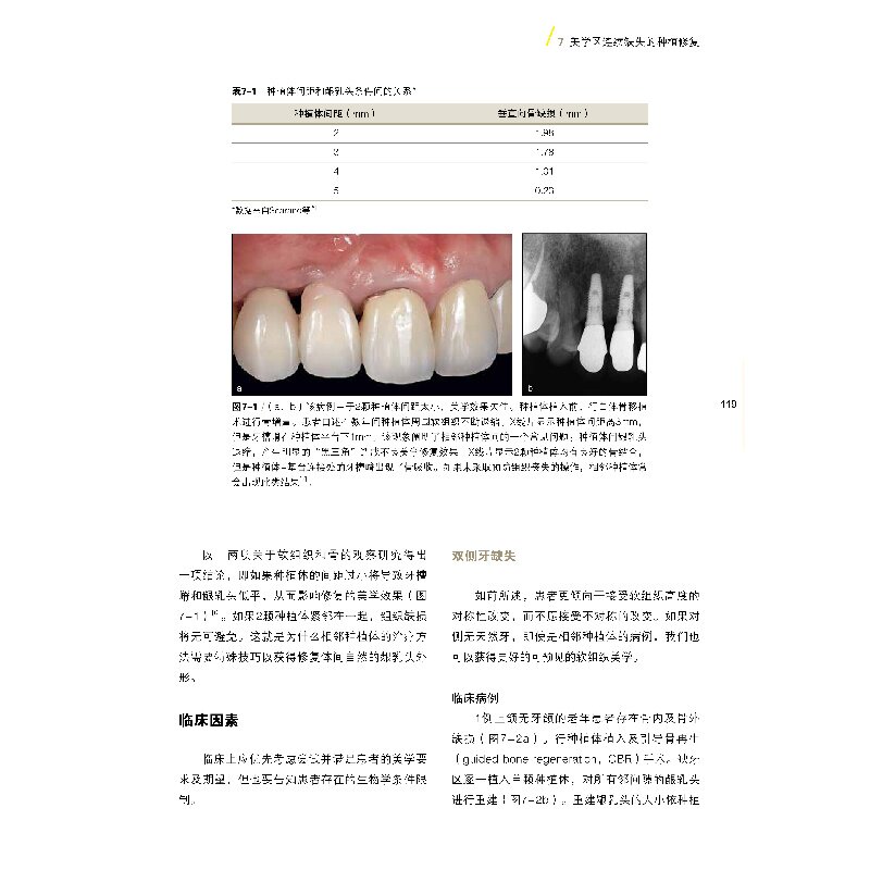 美学区种植成功之道汤春波主编美学区种植的手术设计美学分析外科操作软硬组织增量二期手术方式辽宁科学技术出版社 9787559123305