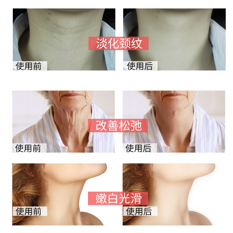 美颈部护理去淡化颈纹霜霜颈纹颈霜 爱肤宜妮希娅颈霜