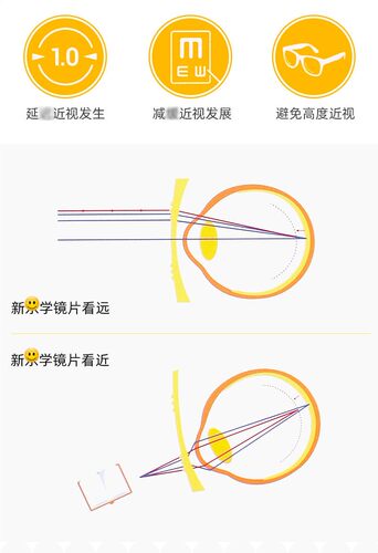 HOYA豪雅新款乐学眼镜片离焦学生儿童青少年近视防控眼镜医院同款 - 图3