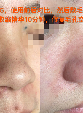500ml白头小气泡院线产品导出液