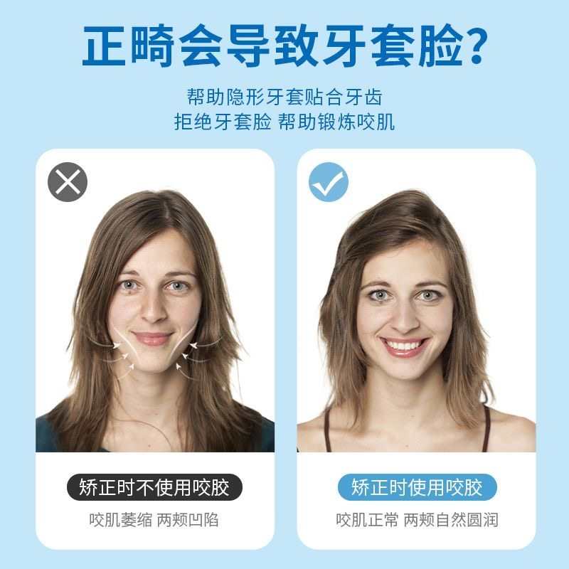 正畸咬胶隐适美隐形牙套脸矫正专用咬胶棒时代天使手持牙胶口咬胶_虎窝淘