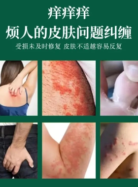 湿痒清抑菌中草膏 全身痒外用皮肤干痒大腿内侧瘙痒红点干燥湿痒