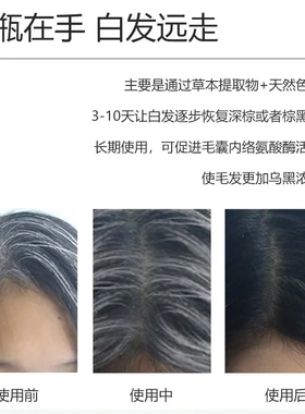 草本植物何首乌黑灵芝乌发乳养护头皮滋养毛囊精华液白转黑护发乳