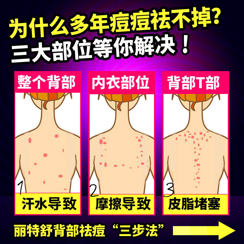 身体护理祛痘浴盐前胸后背沐浴露 丽特舒浴盐