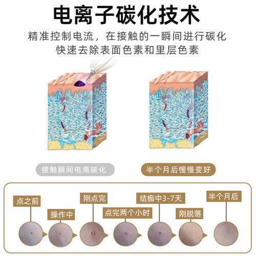 家用点痣正品点痣笔美容院专用去水斑祛痣小白神器激光点痣仪扫斑 - 图1