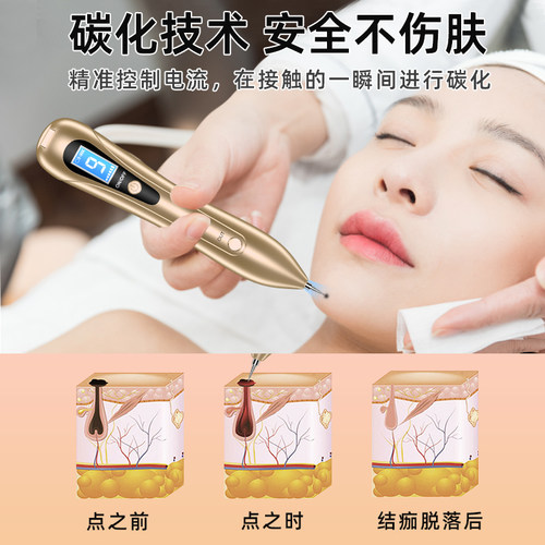 家用点痣正品点痣笔美容院专用去水斑祛痣小白神器激光点痣仪扫斑 - 图2