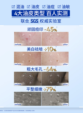 妮维雅630焕皮水油皮补水美白