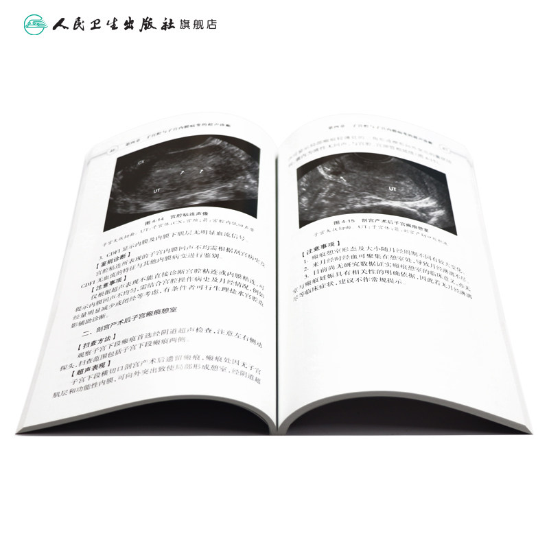 中国妇科超声检查指南(中国医师协会超声医师分会指南丛书)超声诊断学超声医学书籍医学影像学可搭配奈特断层