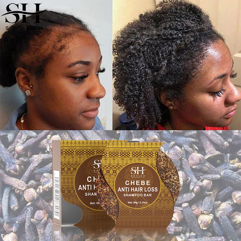 Chebe Hair Growth Oil African Traction Alopecia Treatment - 图2