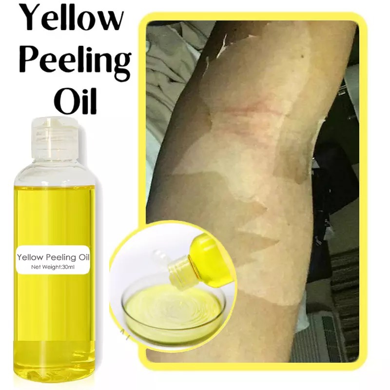 Yellow Peeling Oil Strong Lighten elbows Knees Hands Melanin - 图0