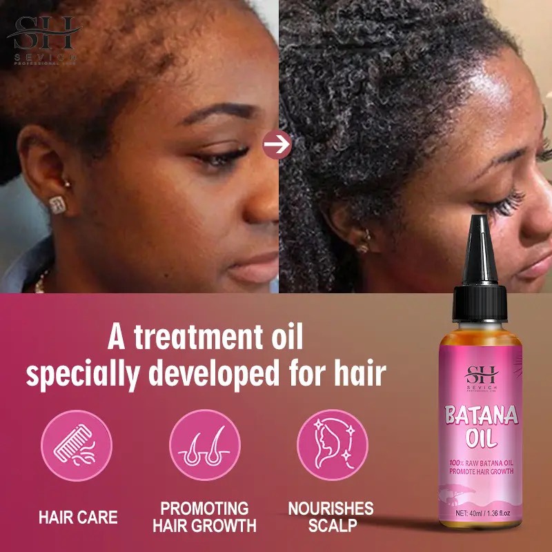 African Fast Hair Growth Chebe Hair oil  BATANA Hair Mask - 图0