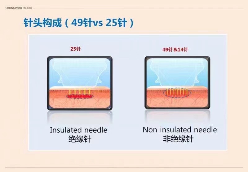 Ellisys plus 黄金射频微针 韩国进口美容仪器 面部抗衰 CHUNGWOO