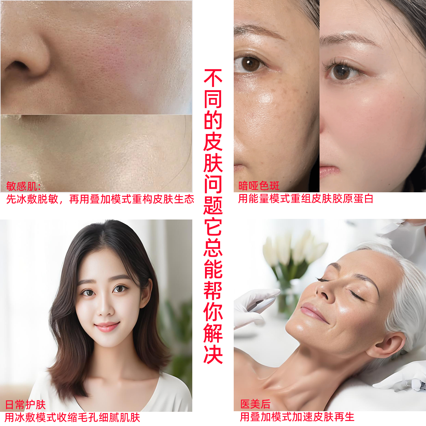 冰频抗衰美颜仪冰锤冷敷仪提位紧致双功能适合面部初老肌松弛下垂 - 图1