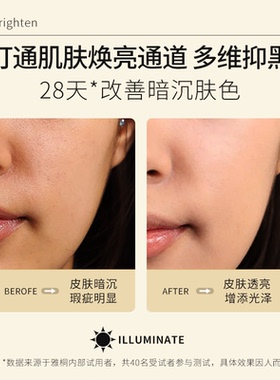 雅桐极光套盒提亮肤色保湿水润