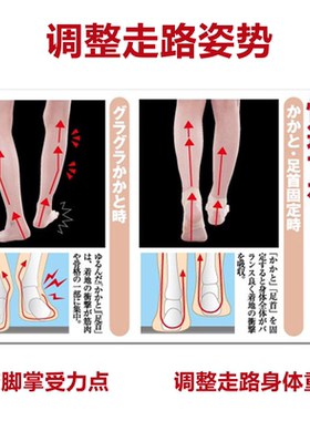 硅胶弹力o型腿走路姿势矫正器