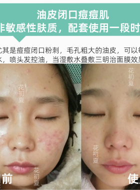 马鞭草酮迷迭香纯露500ml油皮水