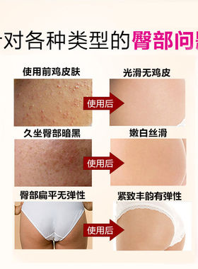 男女士PP美臀膜贴嫩白保湿大腿腹部屁股面膜去坐印翘丰黑二团色素