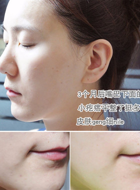 菲诗小铺金盏花水乳水乳套套装