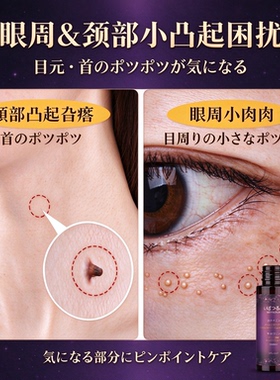 大容量30ml去角质粒原液！日本眼周颈部小凸起肉肉颗粒旮瘩脂肪粒