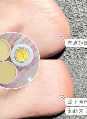 卡贝娜滋润护理膏20g保湿补水滋润改善粗糙干燥足霜舒润护脚后跟