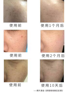 衡美肤套装光皛组合耀白精华焕彩臻白乳律动霜玲珑霜自在畅饮官网