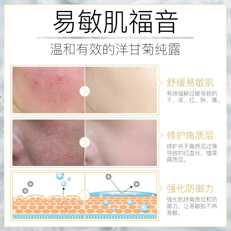 德国洋甘菊天然修复敏感肌肤专用 泊舒纯露/花水