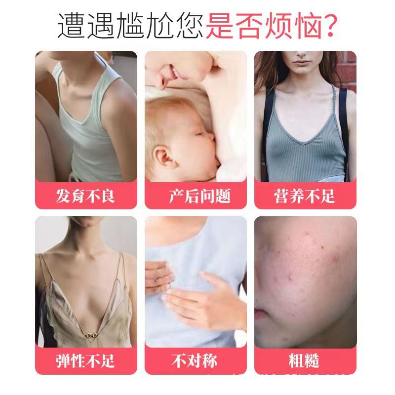 魔姿挺丰姿胶囊正品乳房产品胸部食品懒人变搭木瓜葛根女生必备 - 图3