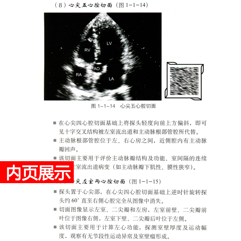 超声掌中宝心血管系统第2二版 杨娅心脏大血管系统疾病超声心动图鉴别诊断要点心内科临床医师超声影像医师工具书科学技术文献 - 图2