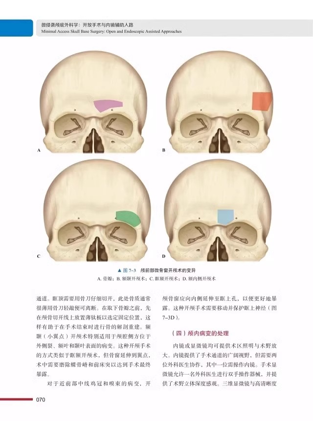 微侵袭颅底外科学 开放手术与内镜辅助入路 张洪钿 外科学书籍 颅底入路解剖 中国科学技术出版社9787523600269 附赠手术视频 - 图2