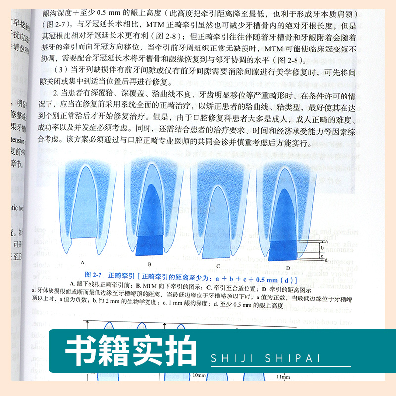 北医版长学制口腔教材第3三版牙体牙髓病学医学正畸学解剖生理学修复学颌面外科学种植学牙周病学黏膜病本科教材书籍全套正版 - 图1