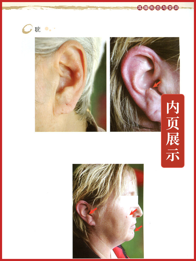正版3本耳穴治疗学耳穴诊断彩色图谱耳穴诊断学第二版第2版黄丽春黄丽耳穴疗法书籍诊疗入门科学技术文献出版社耳穴书中医_虎窝淘