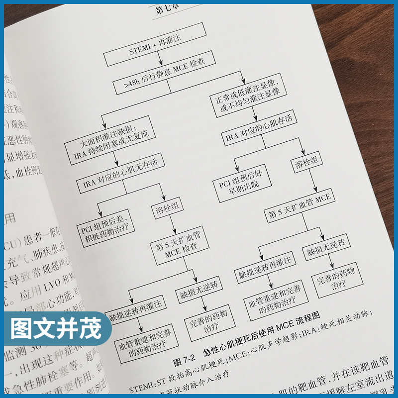 正版中国超声造影临床应用指南中国医师协会超声医师分会指南丛书人民卫生出版社超声诊断学超声医学书籍医学影像学可搭配奈特断层 - 图2