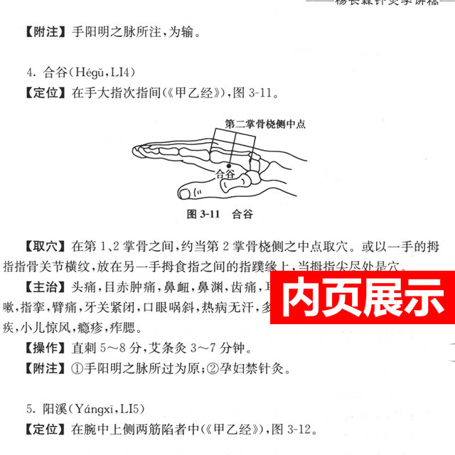 Genuine Yang Changsen's lecture notes on acupuncture and moxibustion. Lecture notes by famous Chinese medicine masters. Yang Changsen's self-study introductory basic theoretical books on acupuncture and moxibustion. Reference books include meridian acupoint acupuncture and moxibustion. People's Health Publishing House